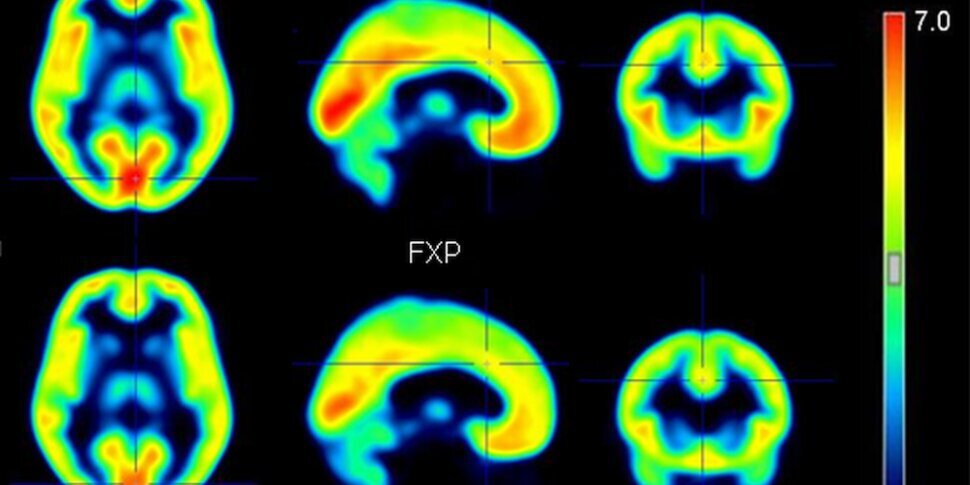 Derde Conferentie over ADNP-gerelateerde en andere Neuro-ontwikkelingsstoornissen